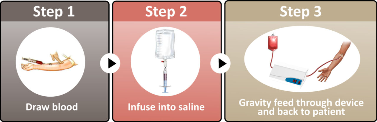 The Science Behind UV Blood Treatment How It Works And Its Remarkable