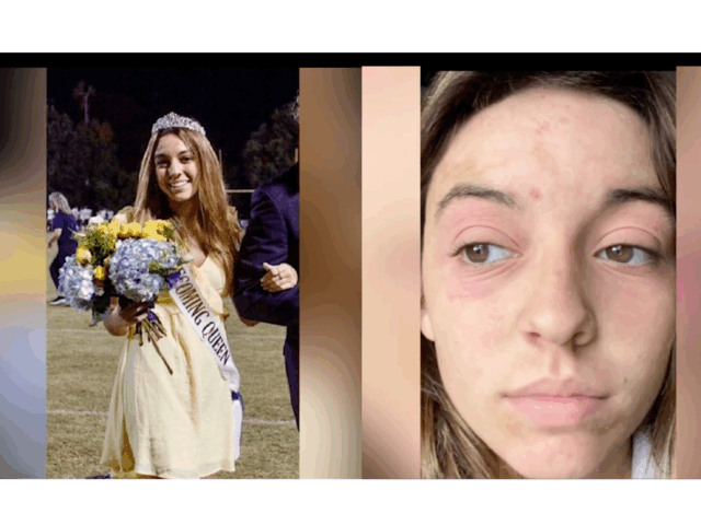 Is Mold Exposure Making You Sick? Ashley’s Story Reveals the Hidden Epidemic Behind Rashes, Anxiety, and Fatigue